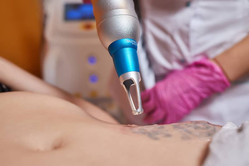 NiSV Akademie: Laserbehandlungen 